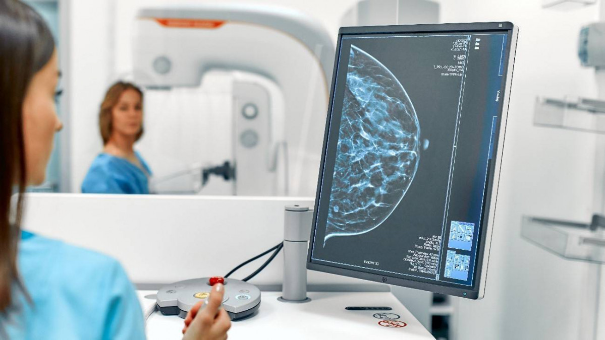 Una densidad mamografica alta podria estar asociada con tumores de peor pronostico